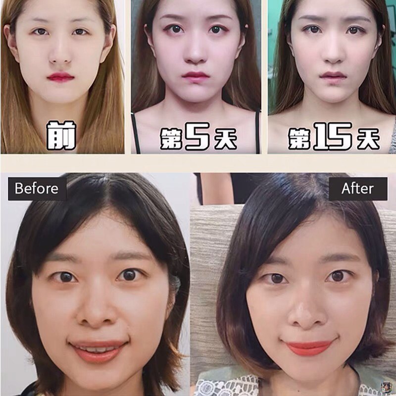 ✨PREORDER✨ Law lines eliminate face-lifting artifact lifting and tightening to remove double chin V-face facial trainer for women and men