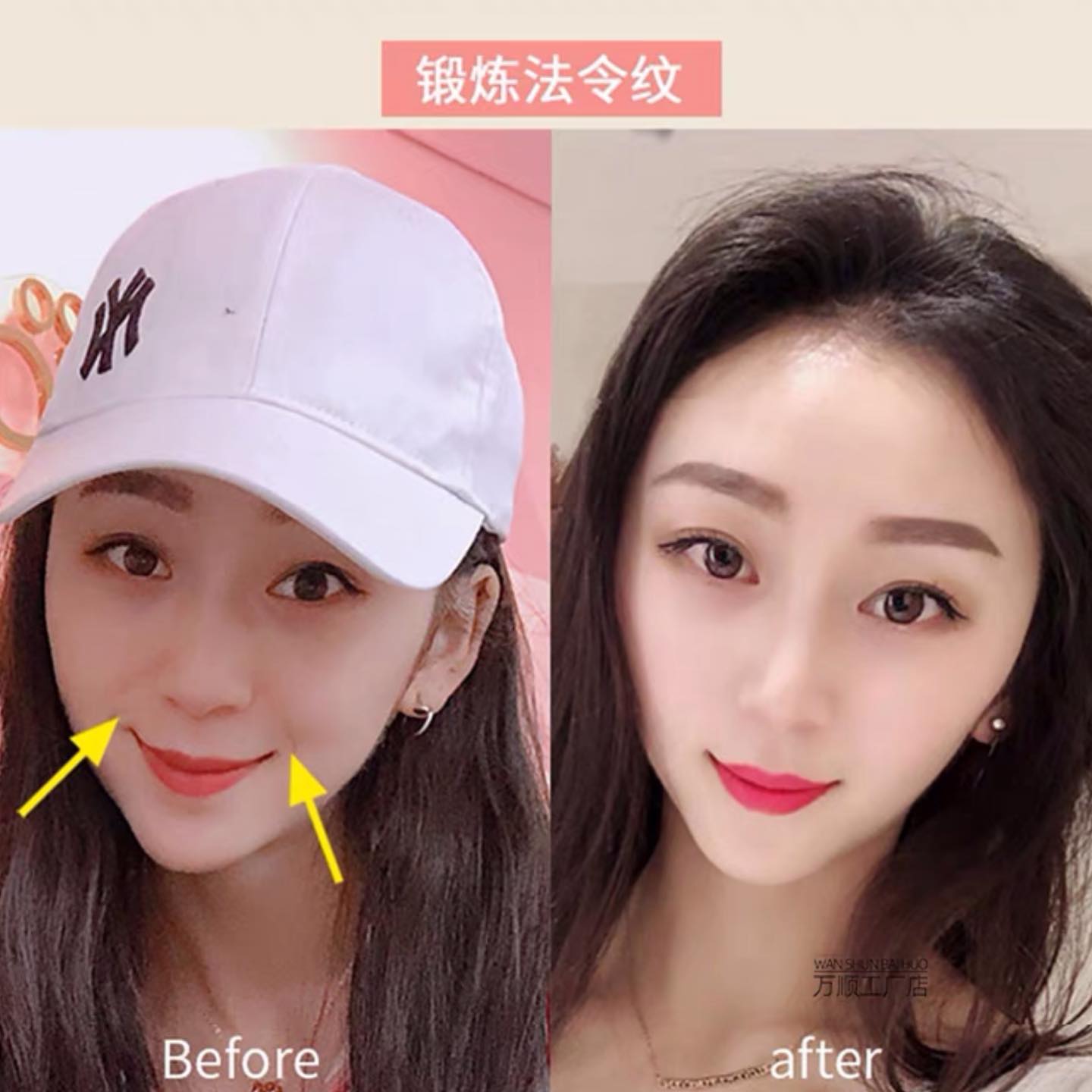 ✨PREORDER✨ Law lines eliminate face-lifting artifact lifting and tightening to remove double chin V-face facial trainer for women and men