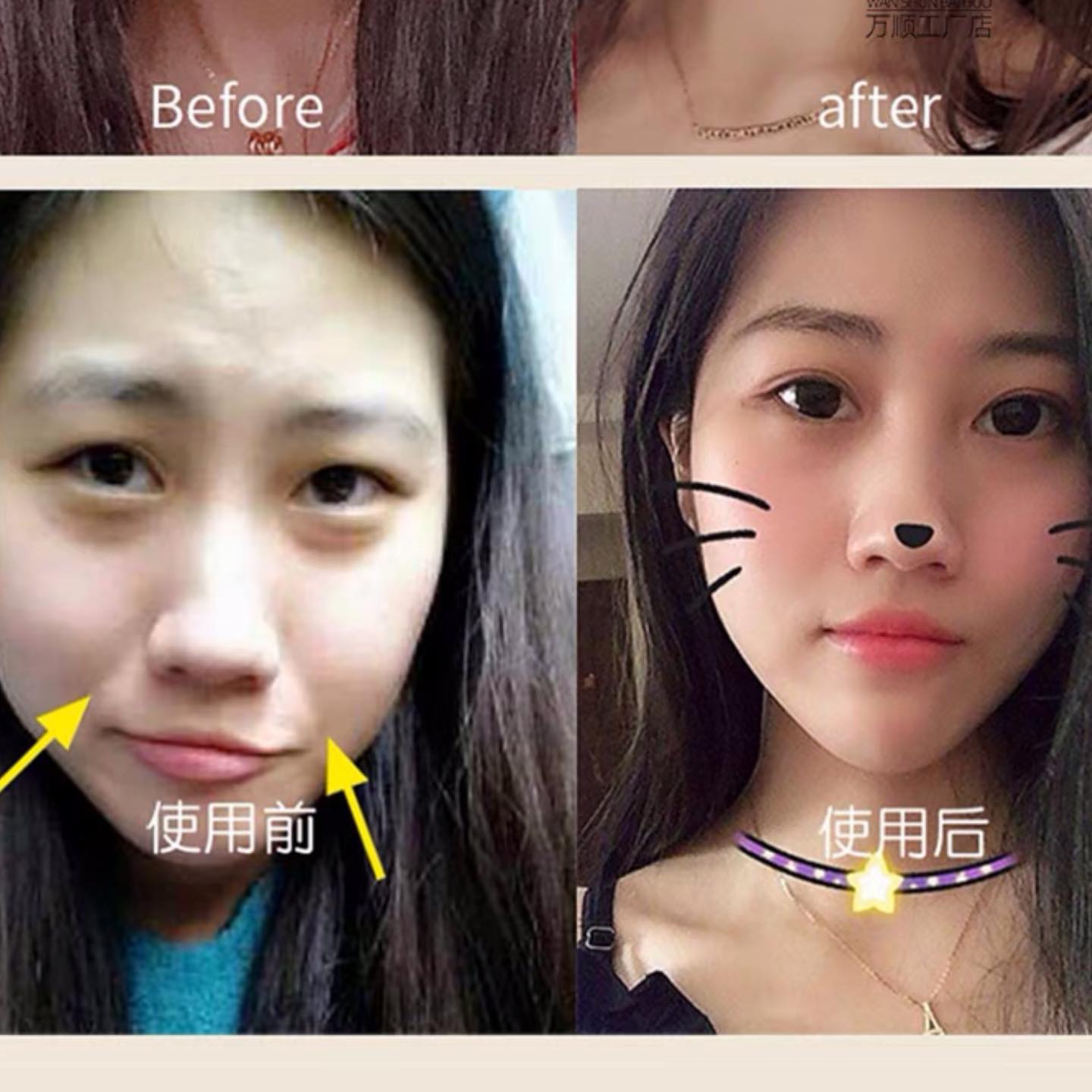 ✨PREORDER✨ Law lines eliminate face-lifting artifact lifting and tightening to remove double chin V-face facial trainer for women and men